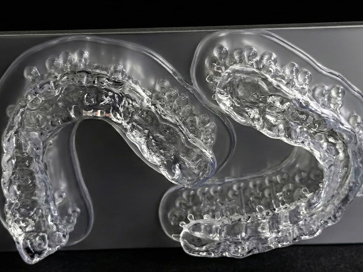 Planos de relajación impresos en 3D vs. termoformados convencionales: qué cambia en la clínica